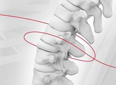 Spine-100-02 (1)